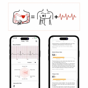 FitMate Lirox Rosegold EKG okosóra- Rózsaszín bőr szíjjal